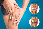 Knee Pain Treatment Frisco